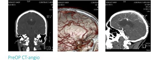 neurosurgery 01