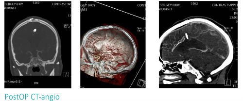 neurosurgery 02